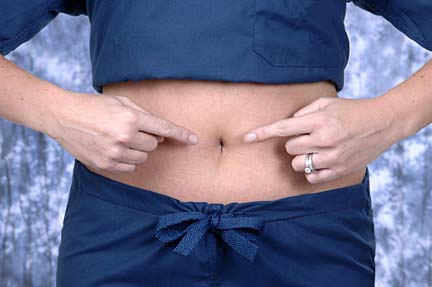 Using Single Incision Laparoscopic Surgery, UT surgeons are able to keep skin flawless by making incisions inside the belly button.
