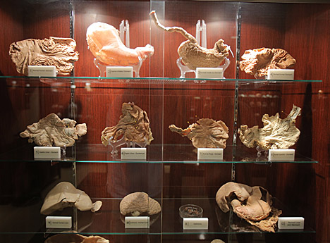 This case focuses on the digestive system in the new Liberato Didio and Peter Goldblatt Interactive Museum of Anatomy and Pathology.