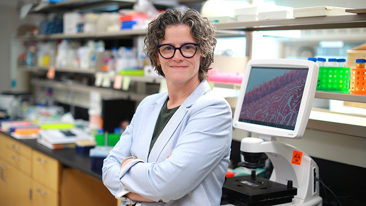 Photo of University of Toledo immunologist Dr. Heather Conti, who has received a federal grant to study how a type of cell unexpectedly discovered in the oral cavity helps the body fight off fungal infections.