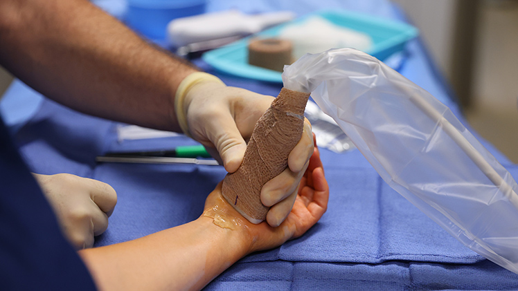 Using real-time ultrasound guidance and a specialized tool developed by Sonex Health, surgeons can precisely locate and divide the transverse carpal ligament to relieve patients' carpal tunnel symptoms.