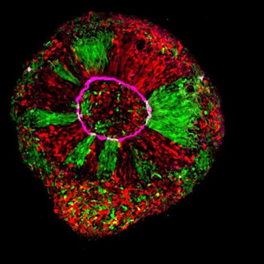 An image of a 20 day old PCDH19 brain organoid